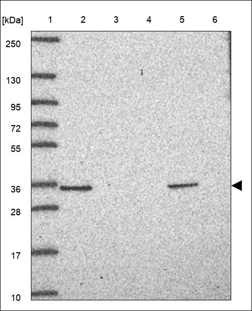 Anti-FRG1 Antibody