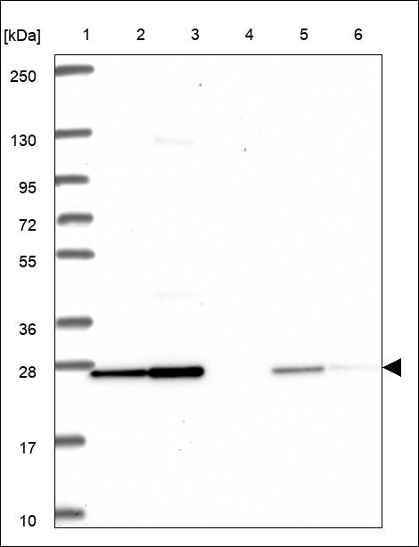 Anti-UBE2K Antibody