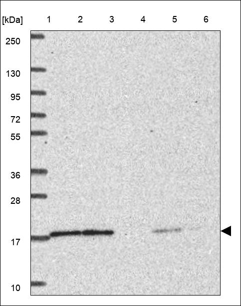 Anti-UBE2V1 Antibody