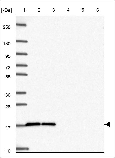 Anti-SRP14 Antibody
