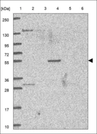 Anti-GLP1R Antibody