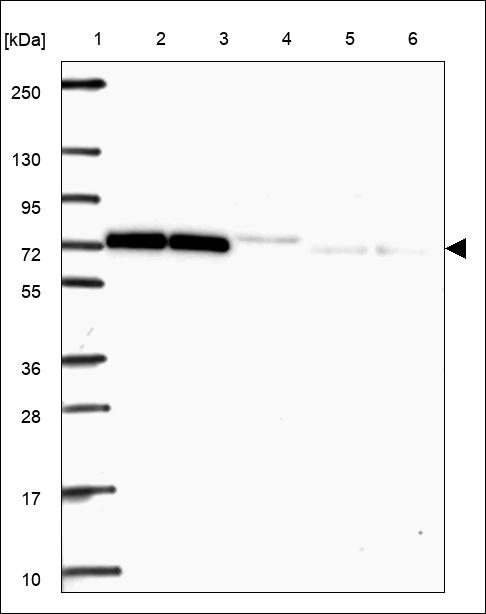 Anti-MMP17 Antibody