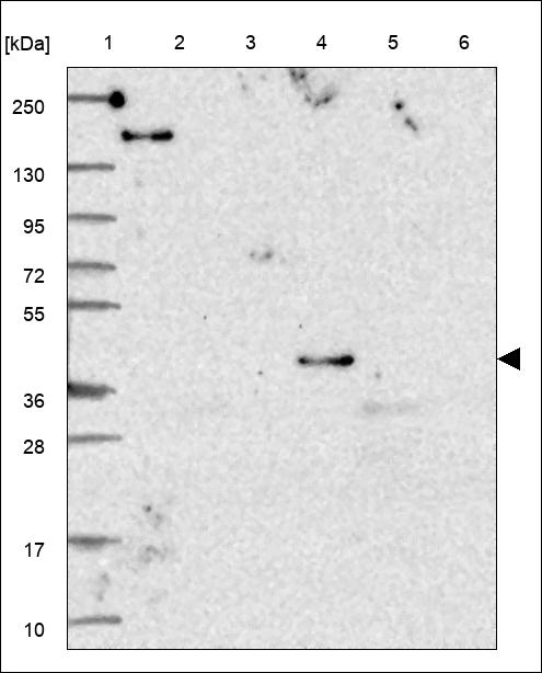 Anti-TNFRSF10D Antibody
