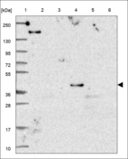 Anti-TNFRSF10D Antibody