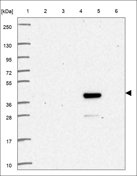 Anti-UGT2A1 Antibody