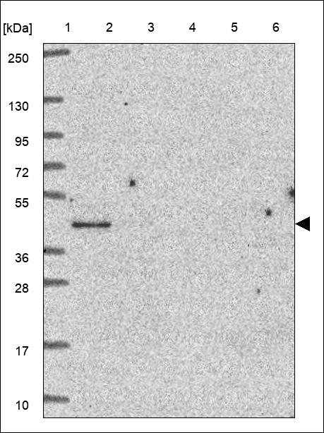 Anti-PTX3 Antibody