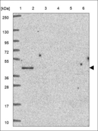 Anti-PTX3 Antibody