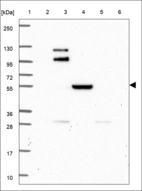 Anti-MMP27 Antibody