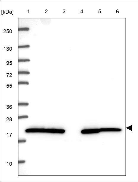 Anti-MED9 Antibody