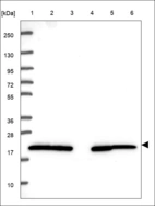 Anti-MED9 Antibody