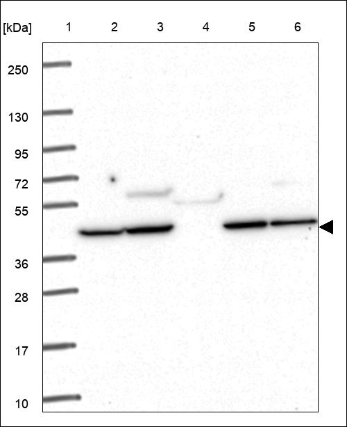 Anti-SMARCD2 Antibody