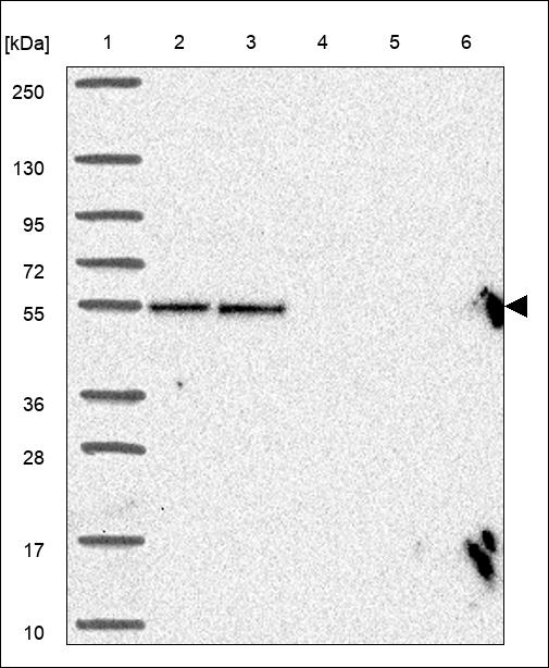 Anti-UBE2Q1 Antibody