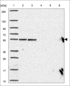Anti-UBE2Q1 Antibody
