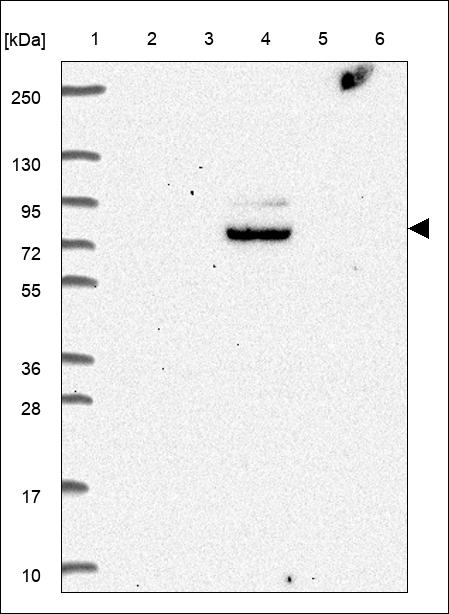 Anti-LARP1B Antibody