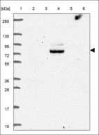 Anti-LARP1B Antibody