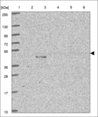 Anti-PARPBP Antibody