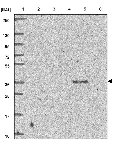 Anti-C11orf54 Antibody