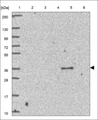 Anti-C11orf54 Antibody