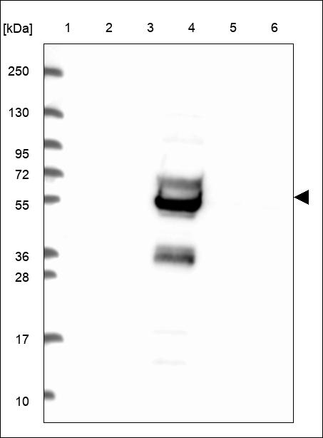 Anti-SPAG8 Antibody