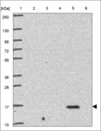 Anti-RARRES2 Antibody