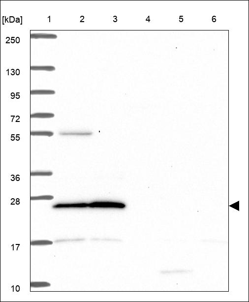 Anti-ZNF414 Antibody