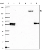 Anti-KDM2B Antibody
