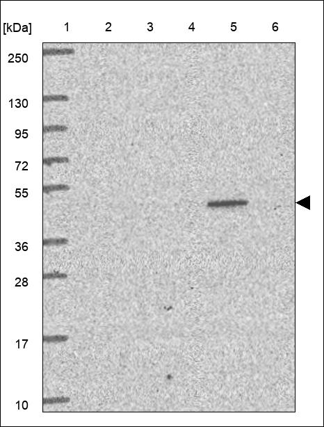 Anti-STK38L Antibody