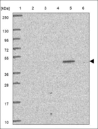 Anti-STK38L Antibody