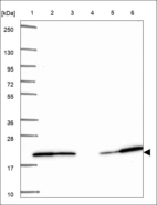 Anti-ARPC4 Antibody
