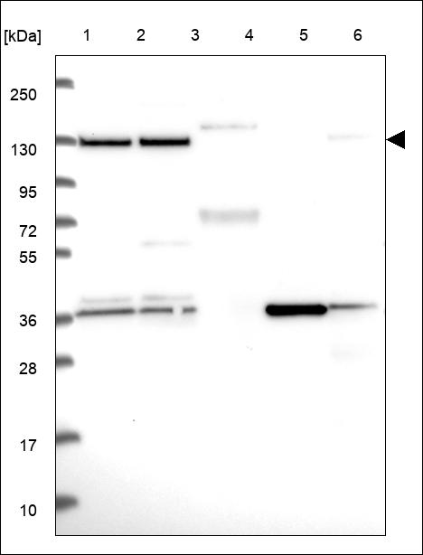 Anti-RNF20 Antibody