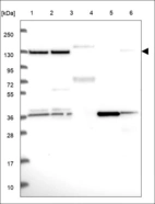 Anti-RNF20 Antibody
