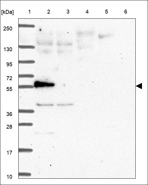 Anti-LIMK2 Antibody