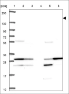 Anti-TUT4 Antibody