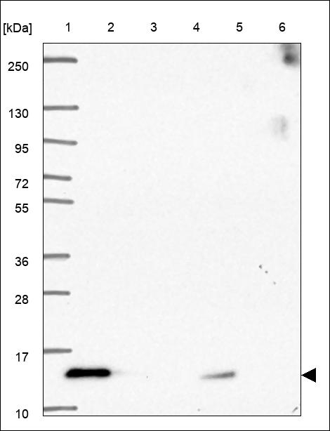 Anti-CHURC1 Antibody