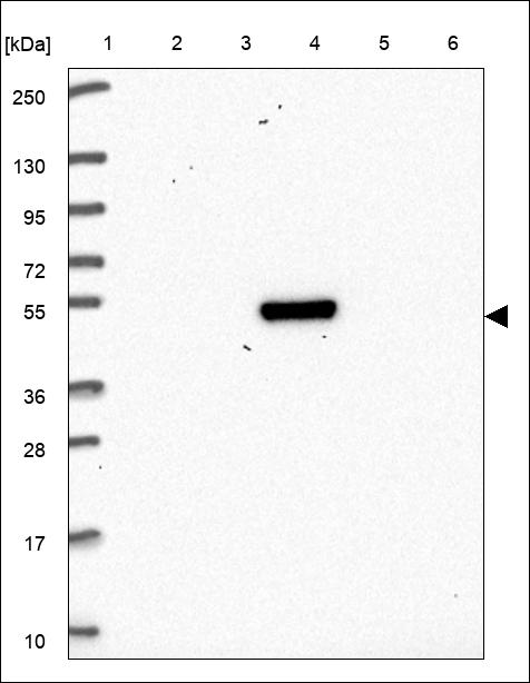 Anti-HS2ST1 Antibody