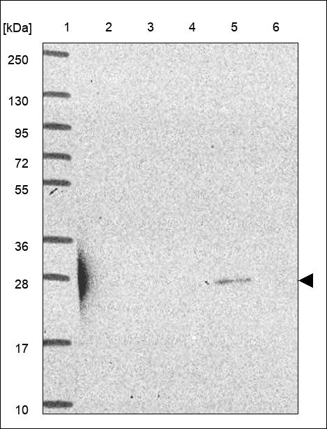 Anti-SLC25A44 Antibody