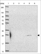 Anti-SLC25A44 Antibody
