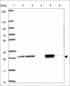 Anti-AK3 Antibody