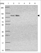 Anti-POLRMT Antibody