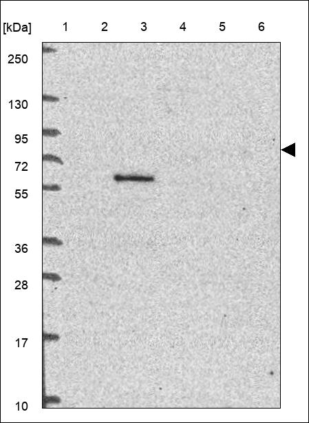 Anti-RHBDF1 Antibody