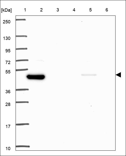 Anti-KLF10 Antibody