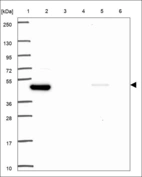 Anti-KLF10 Antibody