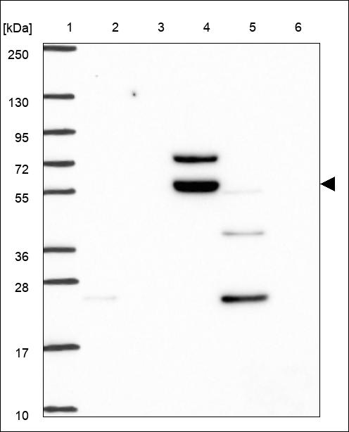 Anti-CYP27B1 Antibody