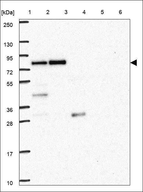 Anti-LIMD1 Antibody