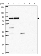 Anti-LIMD1 Antibody