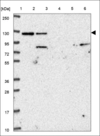 Anti-ADCY6 Antibody