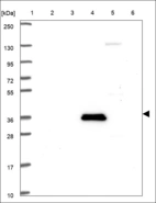 Anti-NMUR2 Antibody