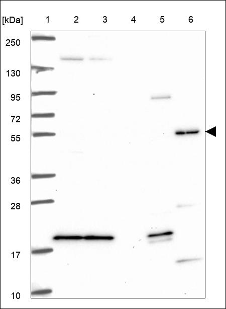 Anti-ING1 Antibody