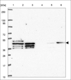 Anti-DNAJB1 Antibody