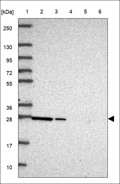 Anti-EFNA5 Antibody